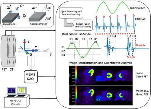 MEMS-based Intrafraction Motion Tracking for PET/CT and Radiotherapy